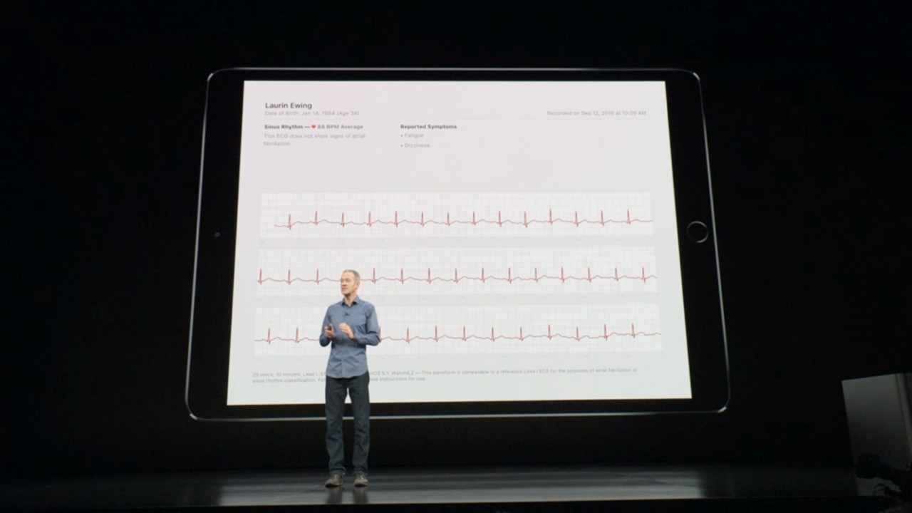 螢幕變大30%的Apple Watch Series 4華麗發表! 偵測三種跌倒模式與全新心電圖測量功能